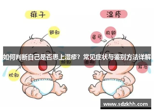 如何判断自己是否患上湿疹？常见症状与鉴别方法详解